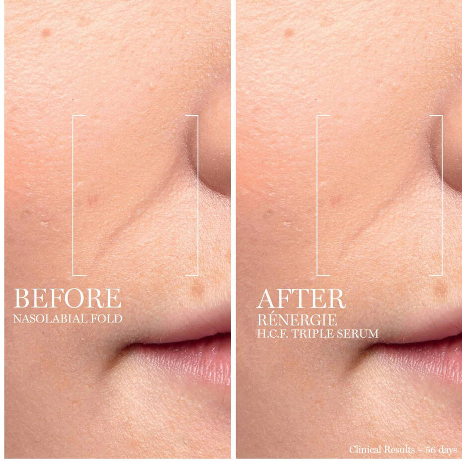 Lancome Renergie H.C.F. Triple Serum 50ml | Advanced Anti-Aging Face Serum