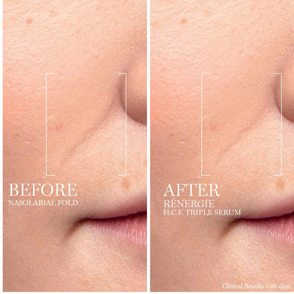 Lancome Renergie H.C.F. Triple Serum 50ml | Advanced Anti-Aging Face Serum
