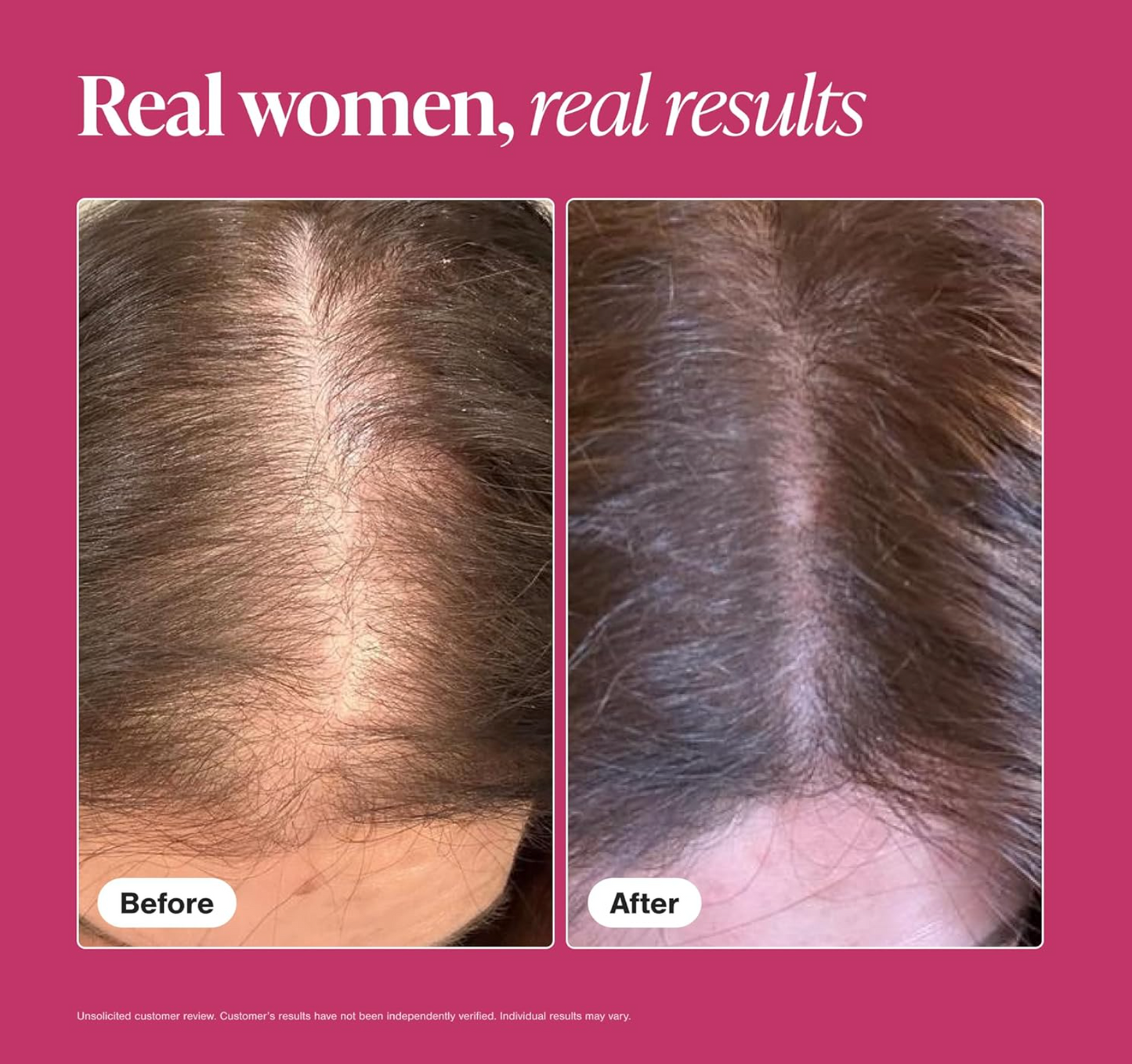 Viviscal Hair Growth Supplements for Women, Thicker Fuller Hair Support for Thinning Hair and Hair Loss, with Biotin and Marine Collagen, Drug-Free, 180 Tablets, 90-Day Supply