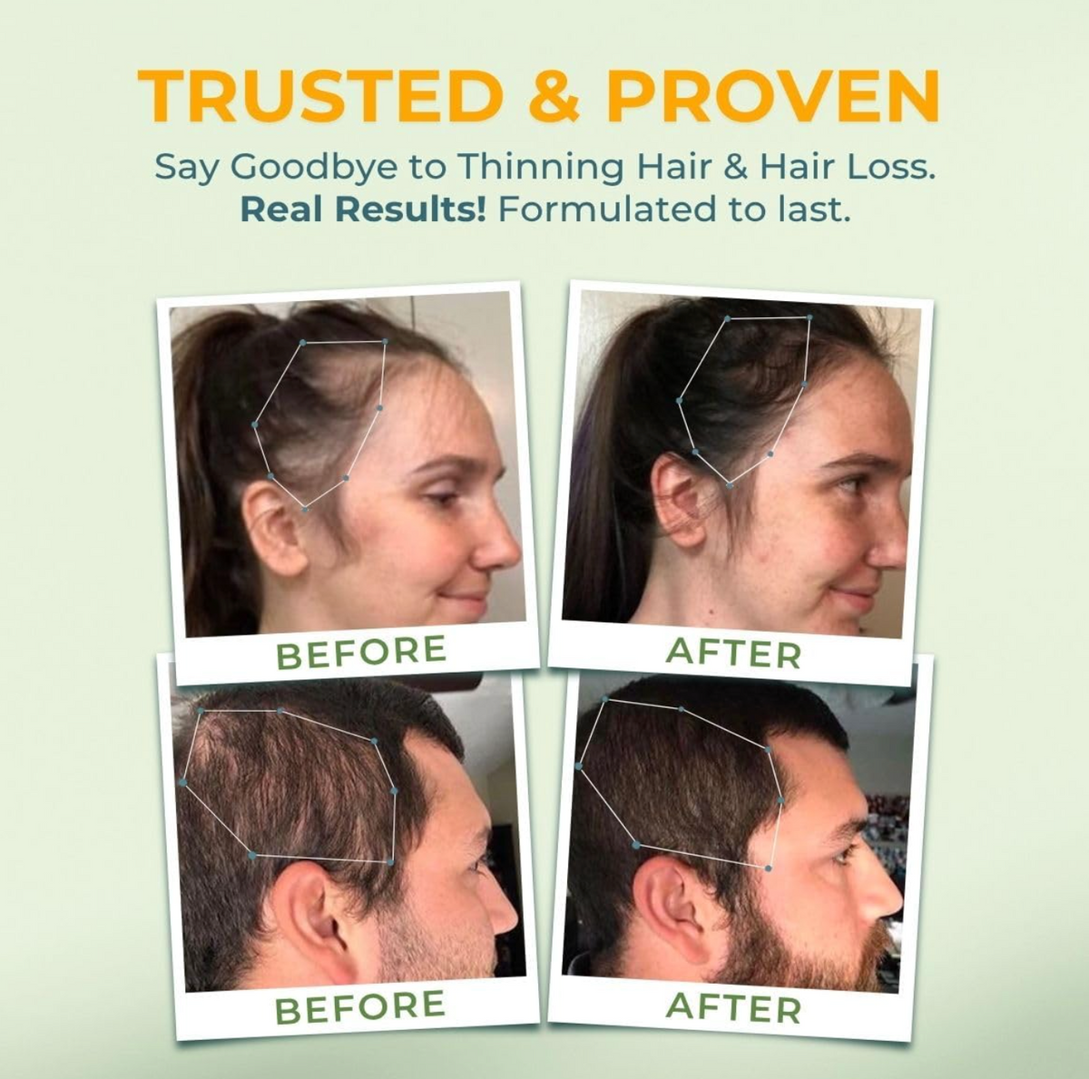 VITAL NUTRITIVE Biotin Hair Growth Vitamins  60 Count